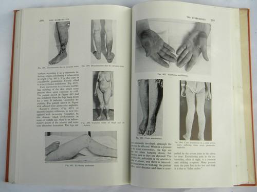 vintage old illustrated medical book w/lots of photos of abnormalities