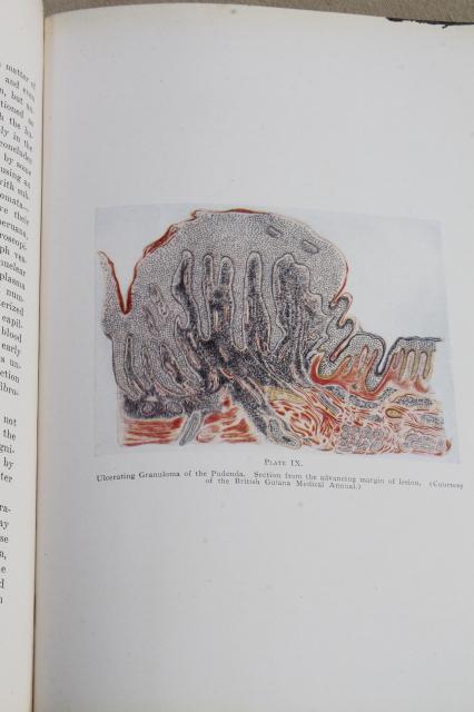1920s vintage medical textbook, Diseases of the Skin, gruesome photos