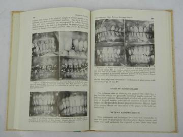 1960s vintage dentistry technical journal periodontal therapy w/photos