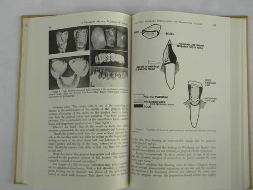 60s vintage dentistry technical journal crown and bridge dental materials