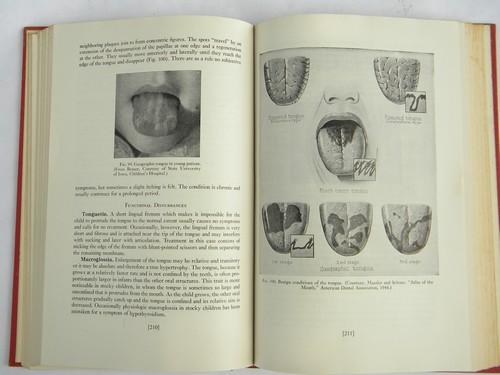 Dentistry for Children, 1950s dentist textbook photos and illustrations