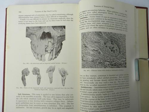 Kronfeld's Histopathology of the Teeth and Their Surrounding Structures