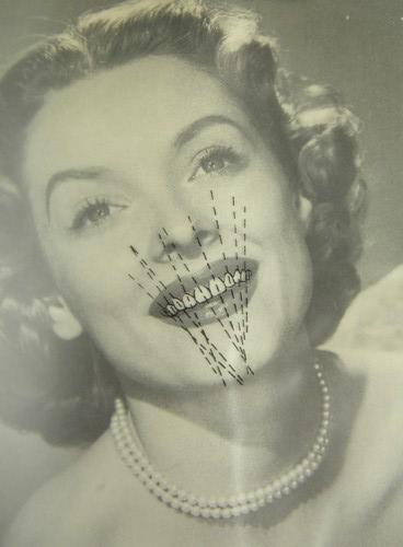 cosmetic dentistry transparences and dental photos, 1950s vintage