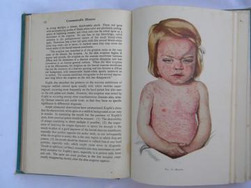 old 1940s medical book Communicable Diseases illustrations and color plates