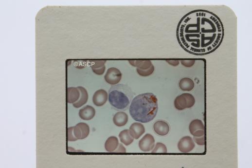vintage medical biology slides, ASCP photos of leukocytes or white blood cells etc., lot of 120 slides