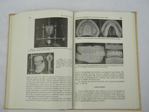 photo of 1960s vintage dental technical journal complete denture prosthesis #1