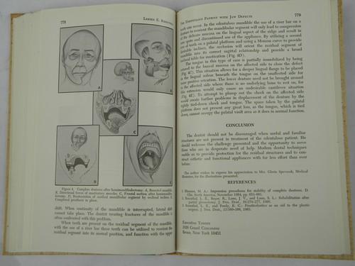 photo of 1960s vintage dental technical journal complete denture prosthesis #2