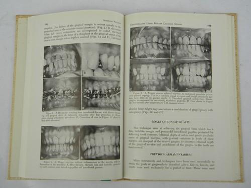 photo of 1960s vintage dentistry technical journal periodontal therapy w/photos #1