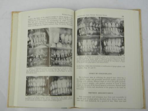 photo of 1960s vintage dentistry technical journal periodontal therapy w/photos #2