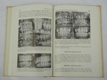 catalog photo of 1960s vintage dentistry technical journal periodontal therapy w/photos