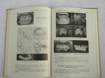 catalog photo of 60s vintage dentistry technical journal crown and bridge dental materials