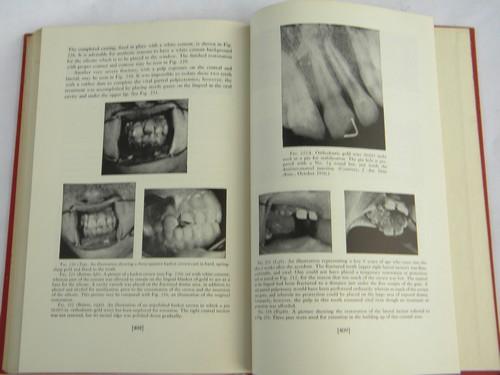 photo of Dentistry for Children, 1950s dentist textbook photos and illustrations #1