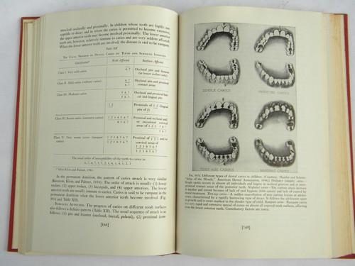 photo of Dentistry for Children, 1950s dentist textbook photos and illustrations #3