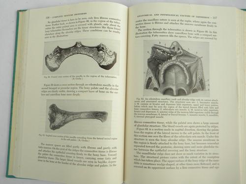 photo of Denture prosthesis and false teeth w/photos, 1950s vintage dental book #2