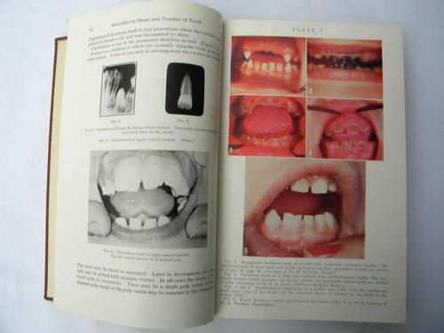 photo of Kronfeld's Histopathology of the Teeth and Their Surrounding Structures #1