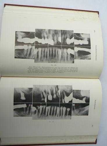 photo of Kronfeld's Histopathology of the Teeth and Their Surrounding Structures #3