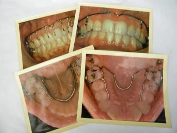 catalog photo of lot four vintage full color glossy dental photographs 8.5'' x 10.5''