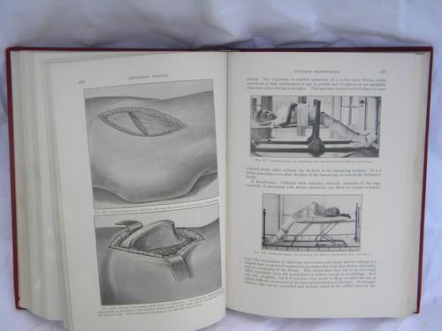 photo of old 1920 medical text orthopedic surgery from doctor's library w/engravings #3