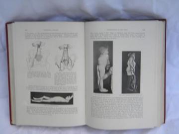 catalog photo of old 1920 medical text orthopedic surgery from doctor's library w/engravings