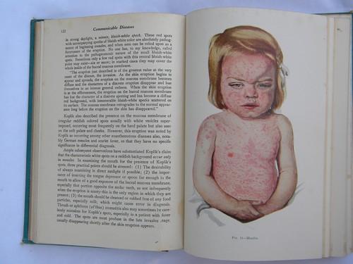 photo of old 1940s medical book Communicable Diseases illustrations and color plates #1