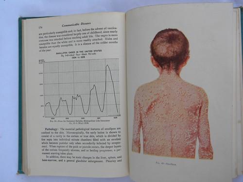 photo of old 1940s medical book Communicable Diseases illustrations and color plates #2