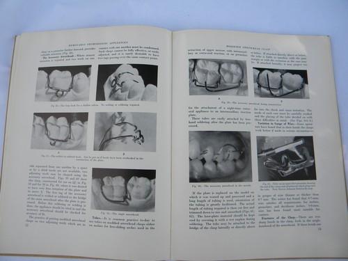 photo of old dentist's technical book designing and building dental braces w/photos #3