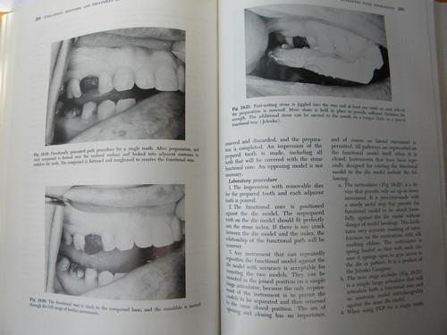 photo of vintage dental textbook treatment of occlusal problems x-rays and photos #2