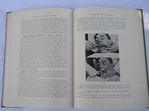 photo of vintage dentist textbook pulling and extracting teeth 350+ illustrations #2