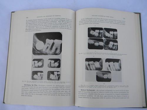 photo of vintage dentist textbook pulling and extracting teeth 350+ illustrations #3