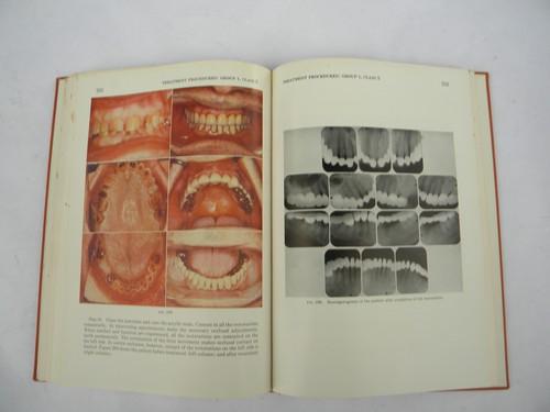 photo of vintage dentistry book Occlusal Rehabilitation, lots of dental photos #1