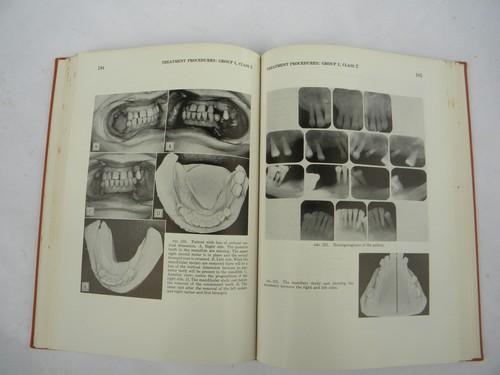 photo of vintage dentistry book Occlusal Rehabilitation, lots of dental photos #2