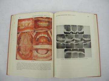 catalog photo of vintage dentistry book Occlusal Rehabilitation, lots of dental photos