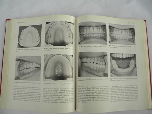 photo of vintage medical and dental textbook diseases of the jaw w/illustrations #3