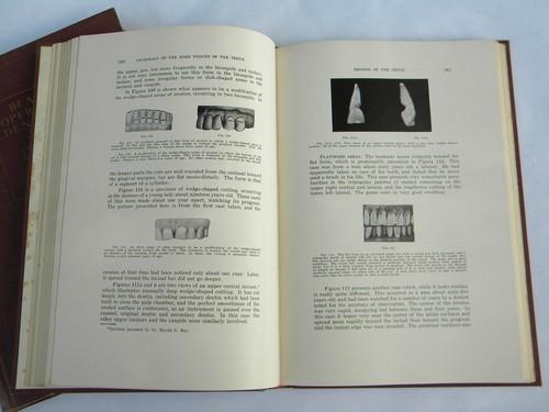 photo of vintage medical books Black's Operative Dentistry w/old dental photos #4