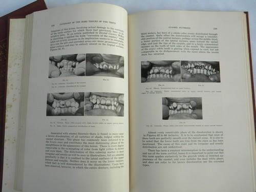 photo of vintage medical books Black's Operative Dentistry w/old dental photos #5