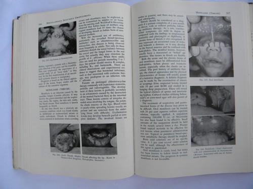 photo of vintage medical dental book Oral Medicine Diagnosis - Treatment #2