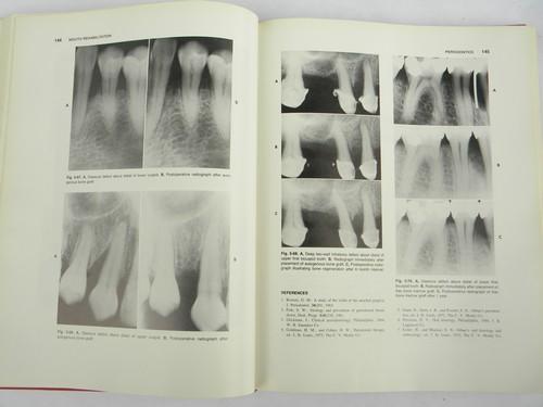 photo of vintage medical dental books on clinical dentistry Mouth Rehabilitation #3