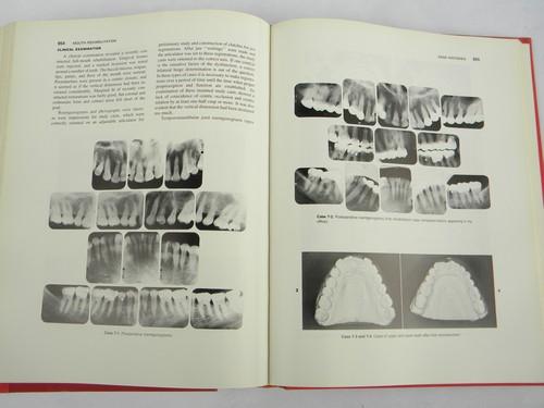 photo of vintage medical dental books on clinical dentistry Mouth Rehabilitation #5