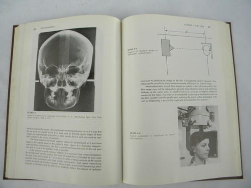 photo of vintage medical handbook facial growth of babies and children w/drawings #2