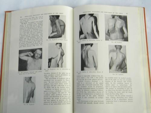 photo of vintage old illustrated medical book w/lots of photos of abnormalities #1