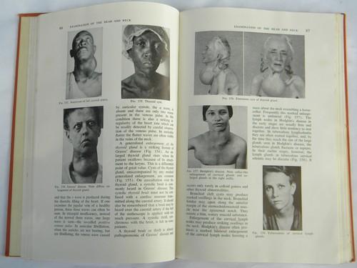 photo of vintage old illustrated medical book w/lots of photos of abnormalities #2