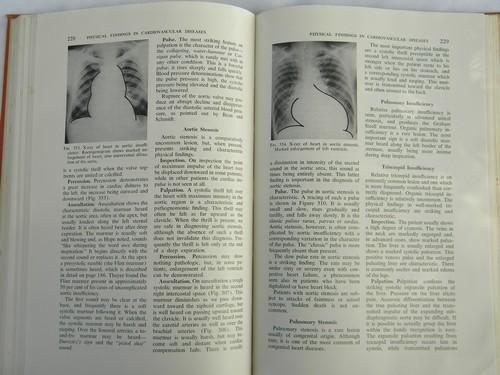 photo of vintage old illustrated medical book w/lots of photos of abnormalities #4