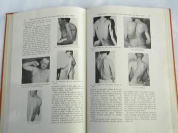 catalog photo of vintage old illustrated medical book w/lots of photos of abnormalities